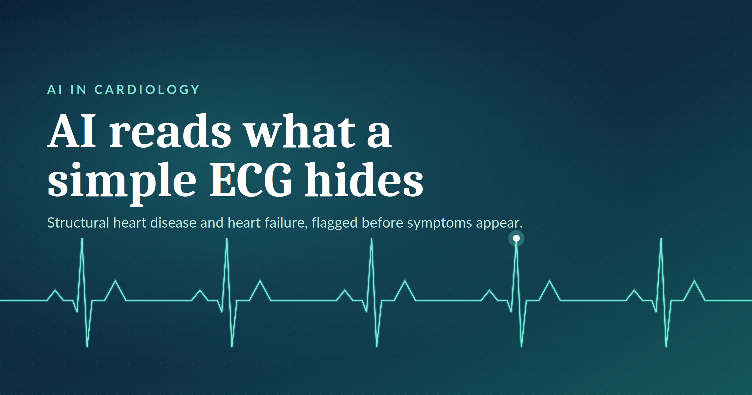 Using AI to Detect Structural Heart Disease and Heart Failure from a Simple ECG