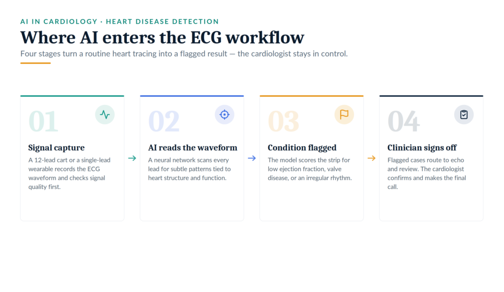 ECG Workflow